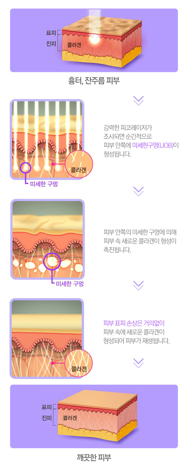 흉터, 잔주름 피부를 깨끗한 피부로!