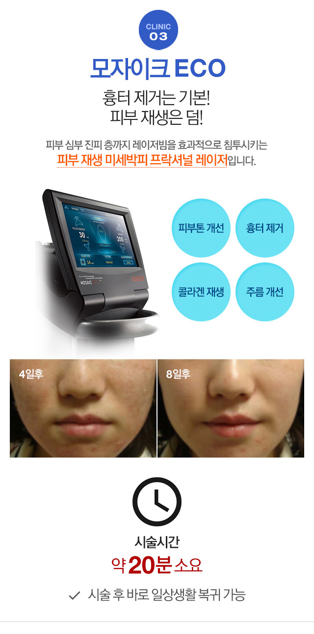 모자이크 ECO 흉터 제거는 기본! 피부 재생은 덤!