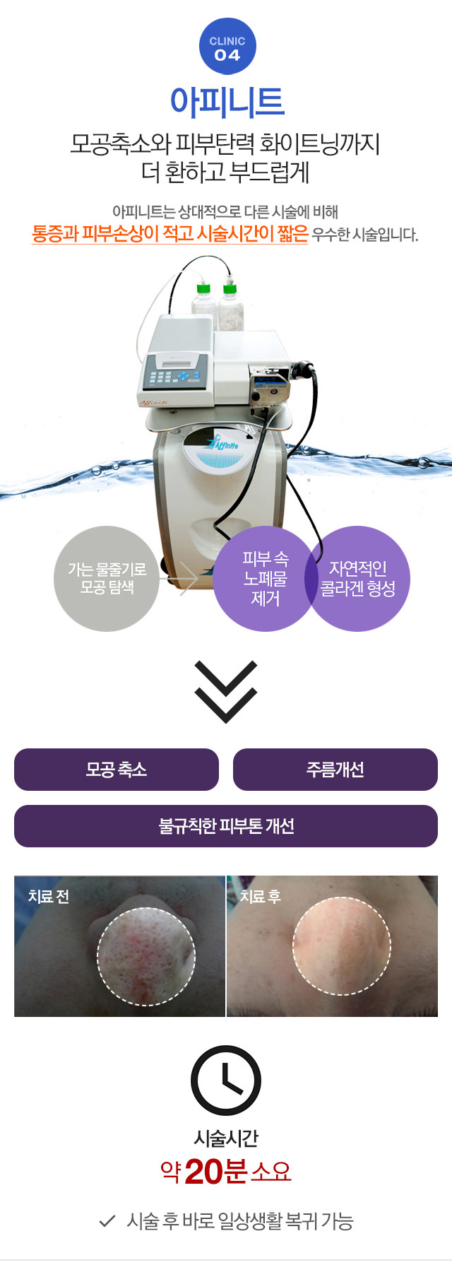 아피니트 모공축소와 피부탄력 화이트닝까지 더 환하고 부드럽게