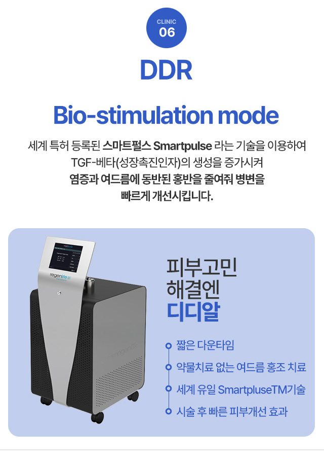 DDR Bio-stimulation mode 세계 특허 등록된 스마트펄스 smartpulse 라는 기술을 이용하여 TGF-베타(성장촉진인자)의 생성을 증가시켜 여믕과 여드름에 동반된 홍반을 줄여줘 병변을 빠르게 개선시킵니다.