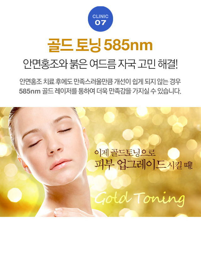 골드 토닝 55nm 안면홍조와 불은 뎌드름 자국 고민 해결! 안면홍조 치료 후에도 만족스러울만큼 개선이 쉽게 되지 않는 경우 585nm골드 레이저를 통하여 더욱 만족감을 가지실 수 있습니다.